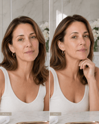 Olyvi RF Beauty Device for Firming & Lifting - Olyvi Beauty